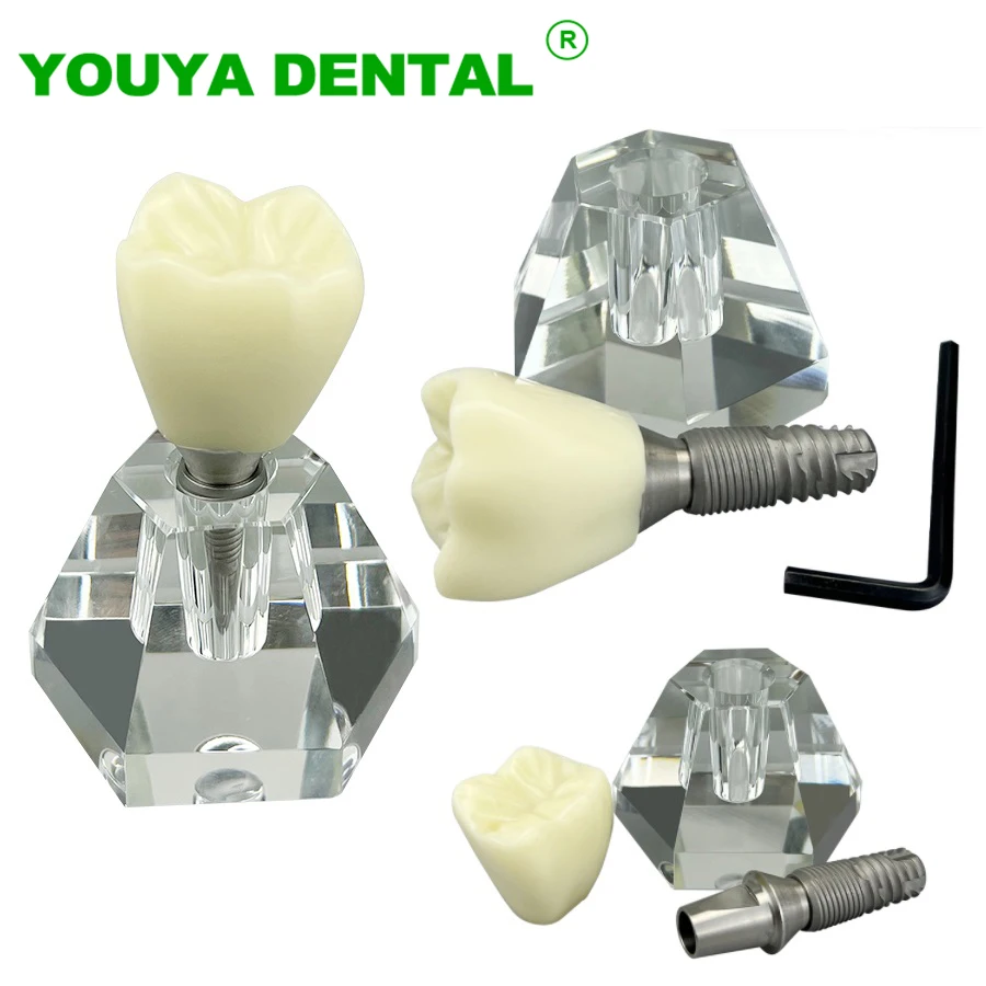 Dantų Dantų Modelis 4 Kartus Vieno Danties Vainiko Implantas Mokymo, Demonstravimo Priemonė, Odontologija, Stomatologas Studentų Mokymo Studijų Modelis . ' - ' . 0